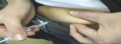 injection-step1