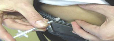 injection-step3